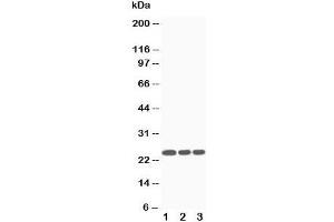 Image no. 1 for anti-Suppressor of Cytokine Signaling 3 (SOCS3) (Middle Region) antibody (ABIN3029044)