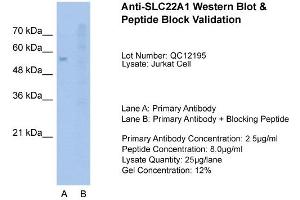 Image no. 3 for anti-Solute Carrier Family 22 (Organic Cation Transporter), Member 1 (SLC22A1) (N-Term) antibody (ABIN2776861)