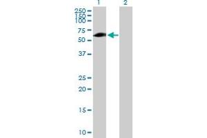 Image no. 2 for anti-Ellis Van Creveld Syndrome (EVC) (AA 1-535) antibody (ABIN515417)