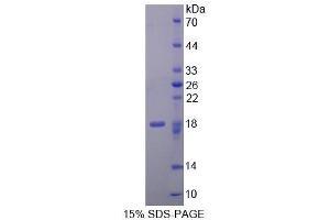 Image no. 1 for Cellular Repressor of E1A-Stimulated Genes 1 (CREG1) (AA 66-196) protein (His tag) (ABIN6236506)