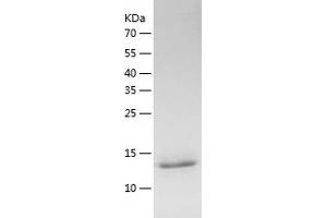 PDZD11 Protein (AA 1-140) (His tag)