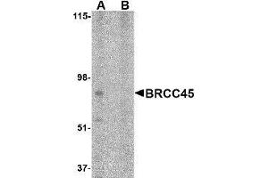 Image no. 2 for anti-Brain and Reproductive Organ-Expressed (TNFRSF1A Modulator) (BRE) (N-Term) antibody (ABIN499497)