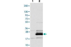 Image no. 2 for anti-Family with Sequence Similarity 96, Member B (FAM96B) antibody (ABIN5577883)