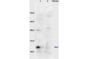 Image no. 2 for anti-Eukaryotic Translation Initiation Factor 4E Binding Protein 1 (EIF4EBP1) (pSer65) antibody (ABIN682963)