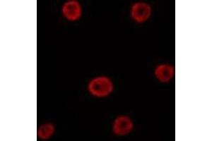 Image no. 2 for anti-GATA Binding Protein 6 (GATA6) antibody (ABIN6257236)