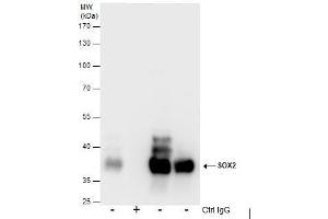 Image no. 3 for anti-SRY (Sex Determining Region Y)-Box 2 (SOX2) (Center) antibody (ABIN2855074)