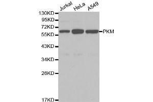 Image no. 2 for anti-Pyruvate Kinase M2 (PKM2) antibody (ABIN3020838)