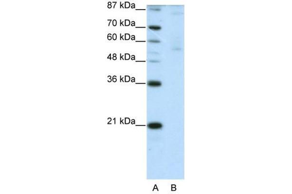 anti-Zinc Finger Protein 92 (ZNF92) (C-Term) antibody
