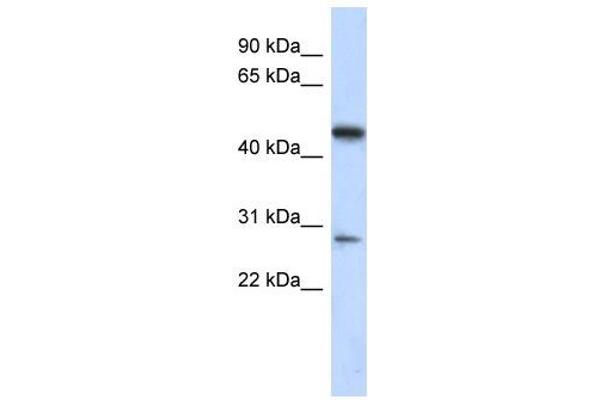 anti-Chromosome 13 Open Reading Frame 31 (C13orf31) (Middle Region) antibody