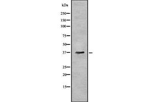 Image no. 1 for anti-Acyl-CoA Wax Alcohol Acyltransferase 1 (AWAT1) antibody (ABIN6260160)