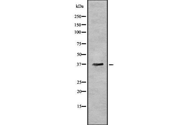 AWAT1 antibody  (Internal Region)