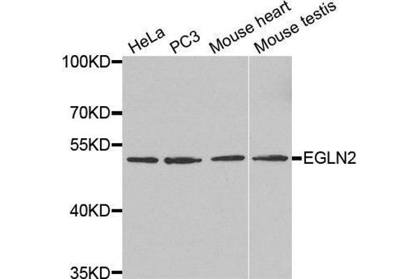 PHD1 Antikörper  (AA 150-250)