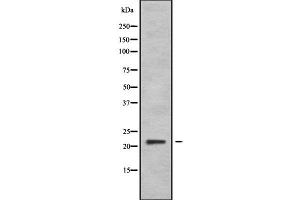 DIRAS2 anticorps  (C-Term)