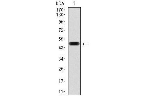 Fibronectin 1 anticorps