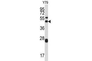 Image no. 1 for anti-Actin Related Protein 2/3 Complex, Subunit 1A, 41kDa (ARPC1A) (Middle Region) antibody (ABIN452761)