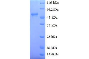 Image no. 1 for Myc Proto-Oncogene protein (MYC) (AA 1-439), (full length) protein (His tag) (ABIN5709983)