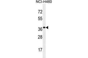 Image no. 2 for anti-Zinc Finger CCCH-Type Containing 15 (ZC3H15) (AA 370-399), (C-Term) antibody (ABIN955636)