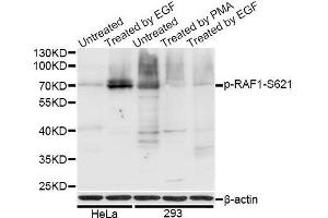 Image no. 2 for anti-V-Raf-1 Murine Leukemia Viral Oncogene Homolog 1 (RAF1) (pSer621) antibody (ABIN3019551)