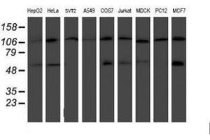 Image no. 13 for anti-Histidyl-tRNA Synthetase 2, Mitochondrial (Putative) (HARS2) antibody (ABIN1498584)