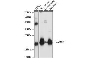 Western blot analysis of extracts of various cell lines, using V antibody (ABIN3021846, ABIN3021847, ABIN1513674 and ABIN6216136) at 1:3000 dilution.