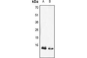 Image no. 2 for anti-Fatty Acid Binding Protein 5 (Psoriasis-Associated) (FABP5) antibody (ABIN3198059)