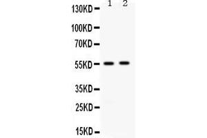 Image no. 2 for anti-Aldehyde Dehydrogenase 3 Family, Member A2 (ALDH3A2) (AA 1-100) antibody (ABIN4886451)