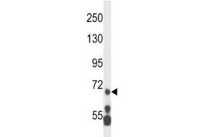Image no. 2 for anti-Myeloid/lymphoid Or Mixed-Lineage Leukemia 5 (Trithorax Homolog) (MLL5) (AA 93-120) antibody (ABIN3031896)