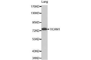 Image no. 1 for anti-Toll-Like Receptor Adaptor Molecule 1 (TICAM1) antibody (ABIN3021572)