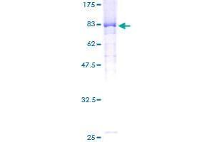 F-Box and WD Repeat Domain Containing 11 (FBXW11) (AA 1-529) protein (GST tag)