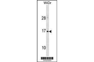 Image no. 1 for anti-Hemoglobin, zeta (HBZ) (AA 95-123), (C-Term) antibody (ABIN1881404)