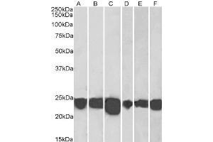 Image no. 4 for anti-Parkinson Protein 7 (PARK7) (C-Term) antibody (ABIN184951)