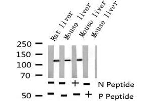 Image no. 4 for anti-Epidermal Growth Factor Receptor (EGFR) (pSer695) antibody (ABIN6255471)