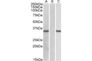Image no. 1 for anti-Cysteine-Rich Secretory Protein 2 (CRISP2) (AA 77-89) antibody (ABIN571122)