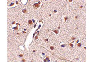 Image no. 3 for anti-Mex-3 Homolog A (MEX3A) (C-Term) antibody (ABIN6656271)