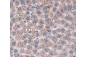 Image no. 2 for anti-CD109 (CD109) (AA 719-965) antibody (ABIN2119840)