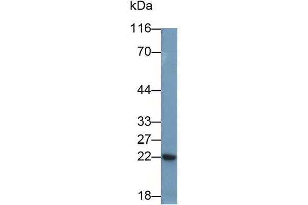 CRP anticorps  (AA 20-222)