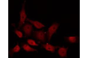 Image no. 3 for anti-Protein Kinase C, delta (PKCd) (pSer645) antibody (ABIN6256394)