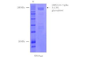 Image no. 3 for SARS-CoV-2 Spike (B.1.351 - beta) protein (rho-1D4 tag) (ABIN6963740)