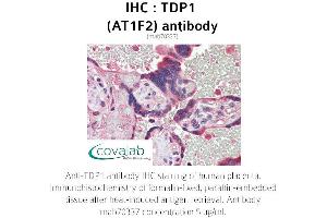 Image no. 2 for anti-Tyrosyl-DNA Phosphodiesterase 1 (TDP1) (AA 1-298) antibody (ABIN1724362)