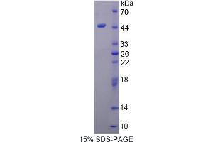 Image no. 1 for Protein Phosphatase, Mg2+/Mn2+ Dependent, 1A (PPM1A) (AA 2-382) protein (His tag) (ABIN6237548)