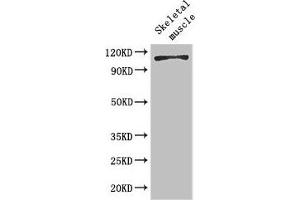 EPH Receptor B6 Antikörper  (AA 410-553)