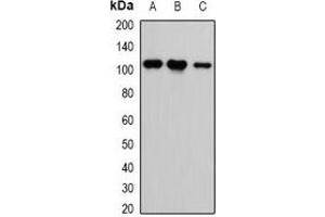 Image no. 1 for anti-Calcium/calmodulin-Dependent serine Protein Kinase (MAGUK Family) (CASK) antibody (ABIN2966497)