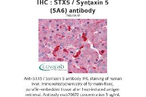 Image no. 1 for anti-Syntaxin 5 (STX5) (AA 1-101) antibody (ABIN1723527)
