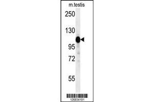 Western Blotting (WB) image for anti-Dapper, Antagonist of beta-Catenin, Homolog 1 (DACT1) antibody (ABIN2158481)