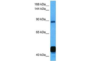 Image no. 3 for anti-Nuclear Factor of Activated T-Cells, Cytoplasmic, Calcineurin-Dependent 2 (NFAT1) (C-Term) antibody (ABIN2780879)