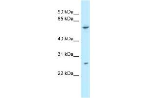 anti-Tetratricopeptide Repeat Domain 39B (TTC39B) (C-Term) antibody