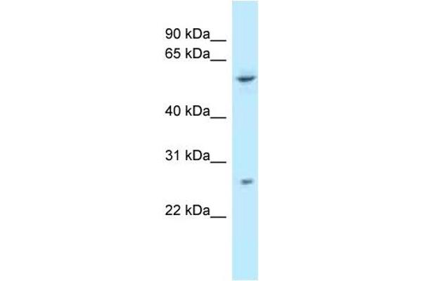 anti-Tetratricopeptide Repeat Domain 39B (TTC39B) (C-Term) antibody