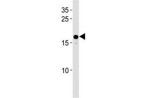 Image no. 2 for anti-High Mobility Group AT-Hook 2 (HMGA2) (AA 64-92) antibody (ABIN3031201)