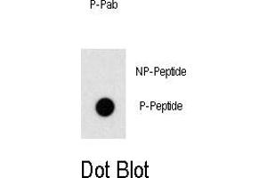 Image no. 1 for anti-Odd-Skipped Related 1 (OSR1) (pThr310) antibody (ABIN358502)