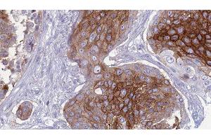 Image no. 2 for anti-Solute Carrier Family 1 (Glutamate/Neutral Amino Acid Transporter), Member 4 (SLC1A4) (C-Term) antibody (ABIN6266271)